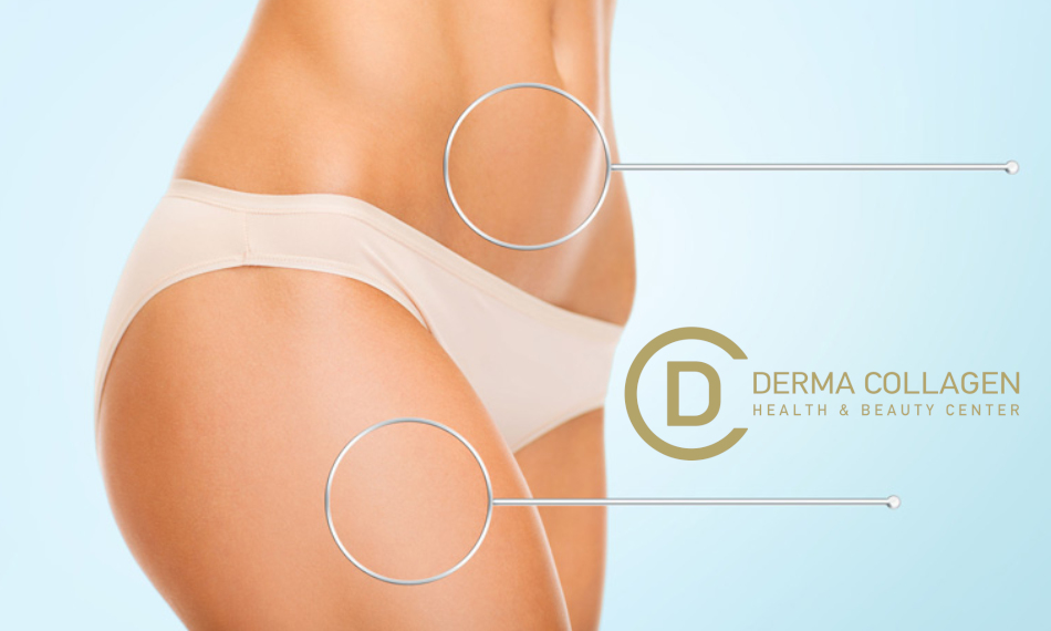 Derma Collagen-Πατησίων, Πατησίων