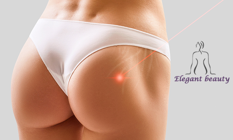 Καταπολέμηση Ραγάδων με Fraxpeel-Laser CO2-Ραδιοσυχνότητες RF