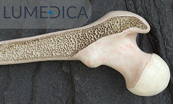 LUMEDICA, Αιγάλεω