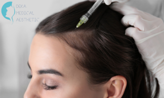 Θεραπεία για τα Μαλλιά με Ενέσιμη Αυτόλογη PRP Μεσοθεραπεία
